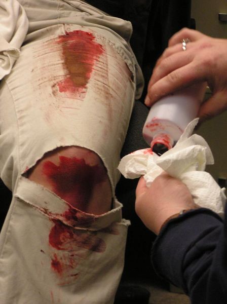Fake blood. Photo by Dawn Ballou, Pinedale Online.