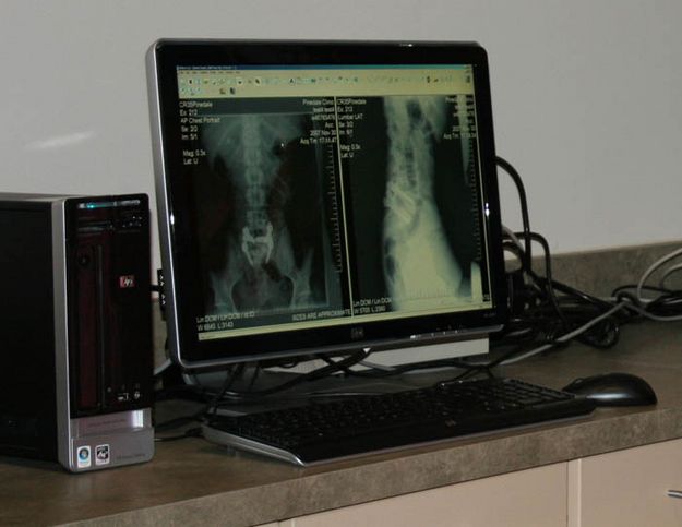 X-Ray computer. Photo by Dawn Ballou, Pinedale Online.